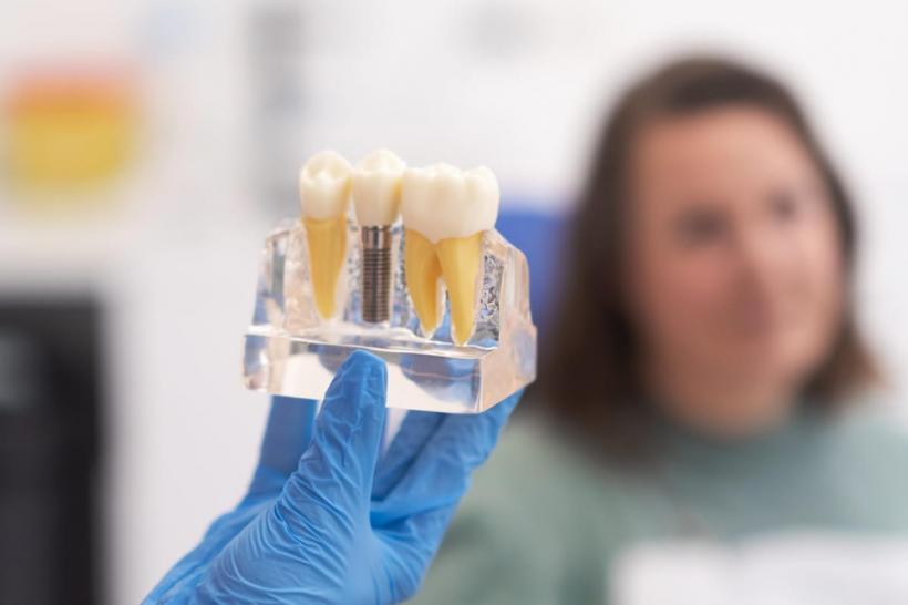 Recuperarea după implant dentar: ce trebuie să știi