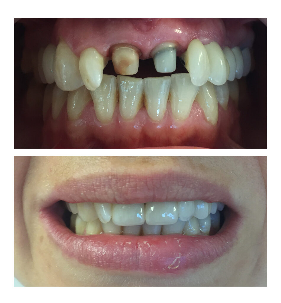 Pentru că încrederea se câștigă în timp și se cântărește în rezultate!